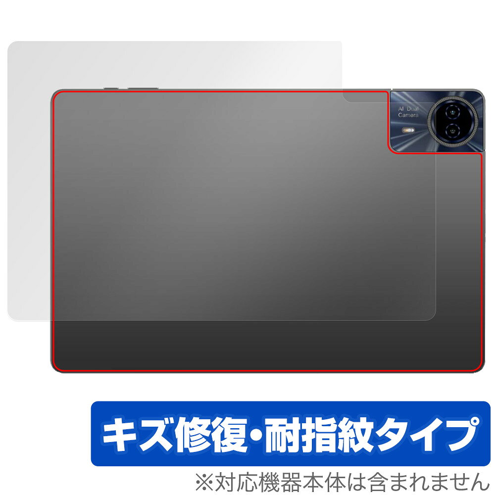 Teclast T65 Max 후면 보호 필름 OverLay Magic for 테라스토 타블렛 본체 보호 필름 상처 수복 지문 방지 코팅
