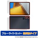 Xiaomi POCO Pad 表面 背面 フィルム OverLay Eye Protector 低反射 for シャオミー ポコ パッド 表面・背面 ブルーライトカット 反射防止(2)