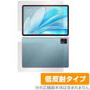 Teclast M50S 表面 背面 フィルム OverLay Plus for テクラスト タブレット 表面・背面セット アンチグレア 反射防止 非光沢 指紋防止(2)