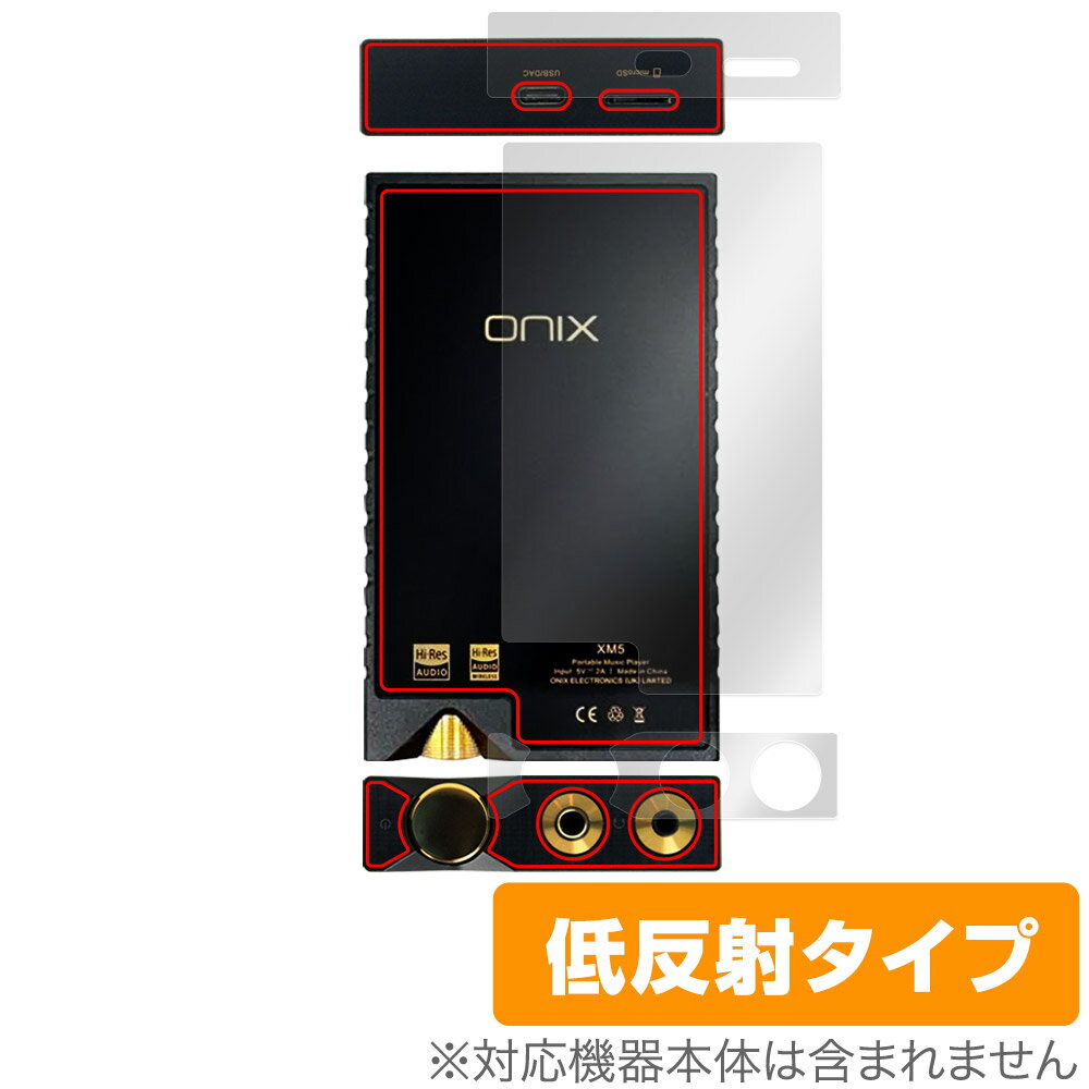 ONIX Overture XM5    ե OverLay Plus for ڥץ졼䡼 쥢 ȿɻ  ɻ