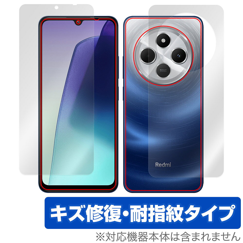 Rakuten - Xiaomi Redmi 14C 表面 背面 フィルム OverLay Magic for シャオミ レドミ 傷修復 耐指紋 指紋防止 コーティング