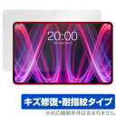 Teclast T60 Plus 保護 フィルム OverLay Magic for テクラスト タブレット 液晶保護 傷修復 耐指紋 指紋防止 コーティング