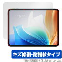 OPPO Pad Neo 保護 フィルム OverLay Magic for オッポ タブレット 液晶保護 傷修復 耐指紋 指紋防止 コーティング