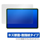 Teclast T60AI 保護 フィルム OverLay Magic for テクラスト タブレット 液晶保護 傷修復 耐指紋 指紋防止 コーティング(2)