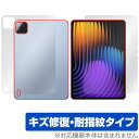 Xiaomi Pad 7 Pro Xiaomi Pad 7 11.2インチ 表面 背面 フィルム OverLay Magic for シャオミー タブレット 傷...