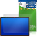 Tabwee W90 保護 フィルム OverLay Magic for タブレット 液晶保護 傷修復 耐指紋 指紋防止 コーティング