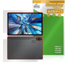 Blackview MEGA 8 表面 背面 フィルム OverLay Plus for ブラックビュー タブレット アンチグレア 反射防止 非光沢 指紋防止(2)