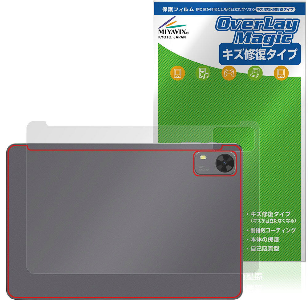 PHILIPS T7315 후면 보호 필름 OverLay Magic for 필립스 타블렛 본체 보호 필름 상처 수복 지문 방지 코팅