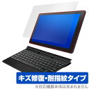 恵安 ノートPC 保護 フィルム OverLay Magic for KEIAN KIC104PRO-BK / KIC104HD-DN / KIC104-BK ...
