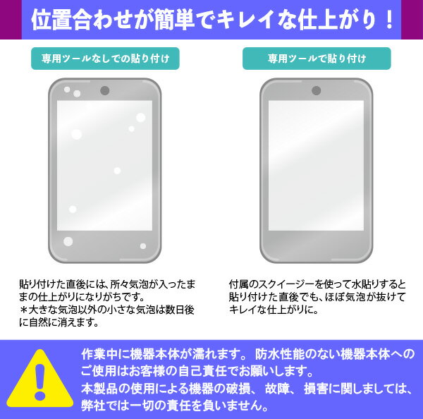 OverLay Flex ���� ��Ž��ġ��륻�å� �ե쥭���֥��Ǻ�Υե�����Ž�� �ߥ�ӥå��� �����С��쥤 �ե�å����˺�Ŭ ���ץ졼 ����ʡ����å� ������������ �ߥ�ӥå���