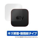 Apple TV 4K 2021 本体 保護 フィルム OverLay Magic for AppleTV 本体保護フィルム キズ修復 耐指紋コーティング アップルTV 天面保護