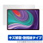 Lenovo Xiaoxin Pad Pro 2021 ݸ ե OverLay Magic for Υ ֥å 㥪 ѥå ץ վݸ  ѻ ɻ ƥ