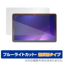 IRIS OHYAMA LUCA Tablet 10インチ TM101N1-B 保護 フィルム OverLay Eye Protector 低反射 for アイリスオーヤマ タブレット TM101N1B ブルーライトカット ミヤビックス