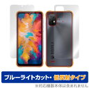 UMIDIGI BISON X10 表面 背面 フィルム OverLay Eye Protector 低反射 for ウミディジ スマートフォン バイソン X10 表面・背面セット ブルーライトカット