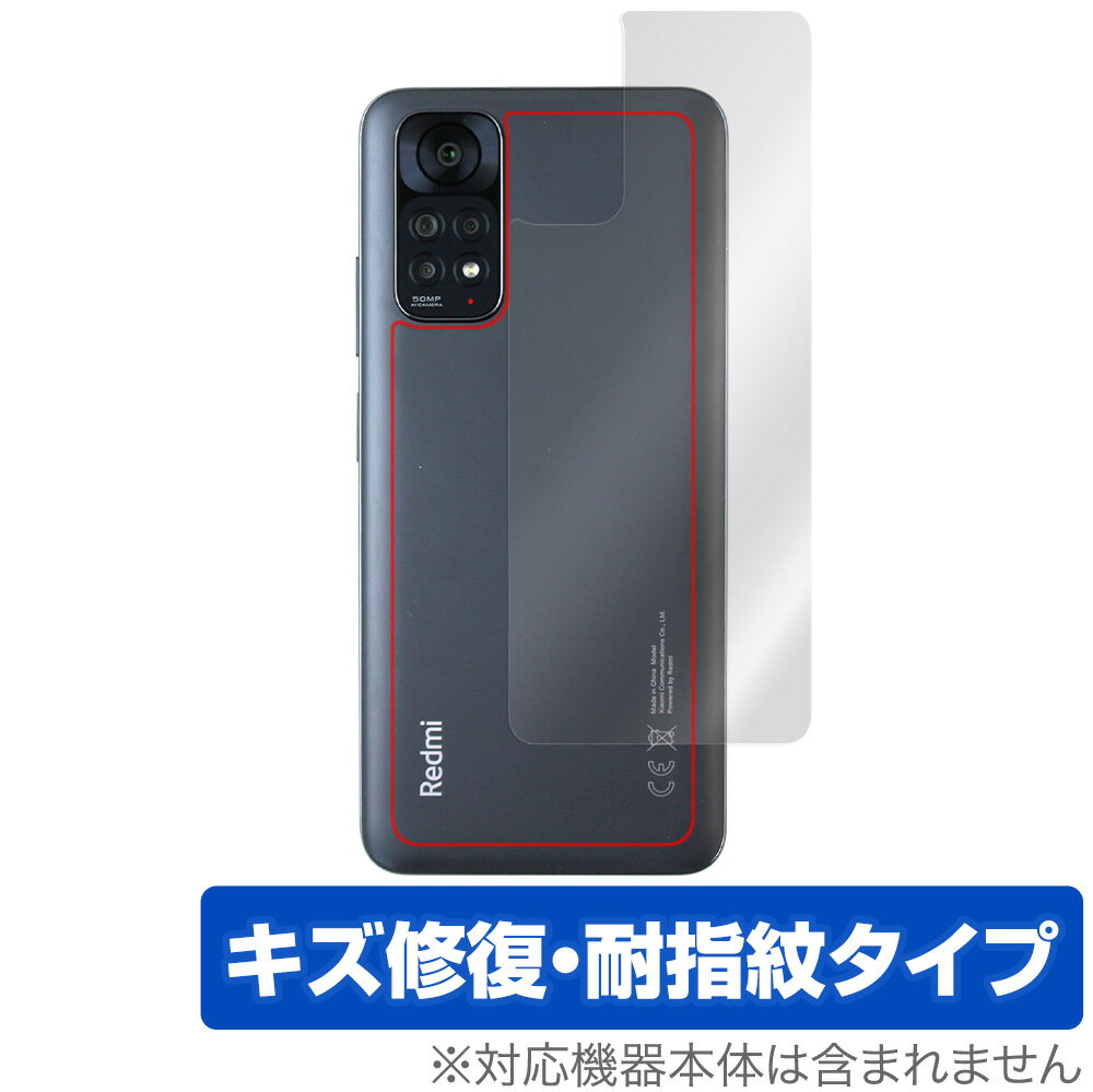 Xiaomi Redmi Note 11S / 11 w ی tB OverLay Magic VI~[ X}z h~ m[g {̕یtB C wh~