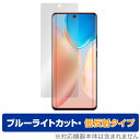 vivo X70 Pro 保護 フィルム OverLay Eye Protector 低反射 for vivo スマートフォン X70 プロ 液晶保護 ブルーライトカット 映り込みを抑える