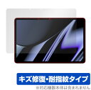 OPPO Pad OPD2101 保護 フィルム OverLay Magic for オッポ Pad OPD2101 タブレット 液晶保護 キズ修復 耐指紋 防...