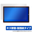 Teclast X16 2021 保護 フィルム OverLay Magic for テクラスト タブレット X16 (2021) 液晶保護 キズ修復 耐指紋 ...