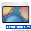 Honor Pad V7 保護 フィルム OverLay Magic for Honor Pad V7 タブレット 液晶保護 キズ修復 耐指紋 防指紋 コーティ...