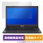 ASUS E210KA 2022 ݸ ե OverLay Plus Lite for  ΡPC E꡼ E210KA վݸ ٱվб 쥢 ȿ  ɻ