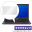 ASUS E210KA 2022 åѥå ݸ ե OverLay Protector for  ΡPC E꡼ E210KA ݸ 쥢 餵꿨