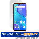 UMIDIGI A7S 保護 フィルム OverLay Eye Protector 低反射 for ウミディジ スマートフォン A7S ブルーライトカット 映り込みを抑える