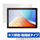 Teclast M40S 保護 フィルム OverLay Magic for テクラスト タブレット M40S 液晶保護 傷修復 耐指紋 指紋防止 コーティング