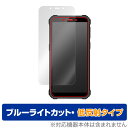 OUKITEL WP20 保護 フィルム OverLay Eye Protector 低反射 for オウキテル スマートフォン WP20 液晶保護 ブルーライトカット 反射防止