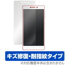 Xiaomi Redmi 3 保護フィルム OverLay Magic for Xiaomi Redmi 3 液晶 保護 フィルム シート シール フィルター キズ修復 耐指紋 防指紋 コーティング スマホフィルム おすすめ ミヤビックス