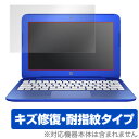 hp Stream11-R016TU 保護フィルム OverLay Magic for hp Stream11-R016TU液晶 保護 フィルム シート シール フィルター キズ修復 耐指紋 防指紋 コーティング スマホフィルム おすすめ ミヤビックス