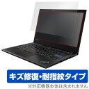 ThinkPad 25 保護フィルム OverLay Magic for ThinkPad 25 / 液晶 保護 フィルム シート シール フィルター キズ修復 耐指紋 防指紋 コーティング ノートパソコン フィルム ミヤビックス