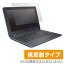 ASUS Chromebook C204 / Chromebook 12 C223NA /? Chromebook Flip C214-BW0029 (Υ󥰥쥢) / C213NA-N3350 ݸե OverLay Plus վ ݸ 쥢 ȿ  ɻ Ρȥѥ ե ߥӥå