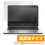 HP EliteBook 820 G3 ݸե OverLay Plus for HP EliteBook 820 G3 / վ ݸ ե   ե륿 쥢  ȿ Ρȥѥ ե ߥӥå