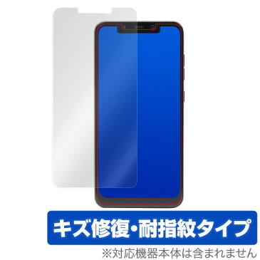 Xiaomi Pocophone F1 保護フィルム OverLay Magic for Xiaomi Pocophone F1【ポストイ ン指定商品】 液晶 保護 フィルム シート シール フィルター シャオミ ポコフォン エフワン