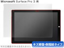 Surface Pro 3 保護フィルム OverLay Magic for Surface Pro 3 保護フィルム 保護シール 保護フィルム キズ修復 耐指...