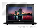 Inspiron Mini 10 保護フィルム OverLay Brilliant for Inspiron Mini 10(OBIM10) 保護フィルム 保護シート 液晶保護フィルム 液晶保護シート 液晶ハードコーティング 高光沢タイプ 光沢 グレア スマホフィルム おすすめ ミヤビックス