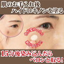 シミ シミ取りクリーム ハイドロキノン シミ取り 男性用 シミ消し 美容液 しみ そばかす 消し 消す 口コミ 美白 メンズ 化粧品 クリーム 手の甲 消える くすみ 市販 最強 取り 背中 しみとり レディース