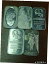 ڶ/ʼݾڽա ƥ    [̵] Vintage Lot Of 5, 1oz .999 Silver Bars NTM &Others 5 try Oz Total