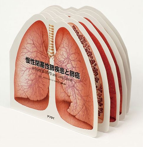 アプライ 型抜き絵本 慢性閉塞性肺疾患と肺癌 TP011