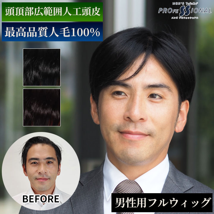 【10％OFFクーポン対象】【新色発売】ウィッグ メンズ 人毛100％ フルウィッグ 男性用 「スタイリッシュショート」自然 かつら 脱毛 医療用 薄毛隠し バレない メンズかつら 男性用かつら ブラック 黒髪 育毛・増毛中も TefuRe 全頭かつら