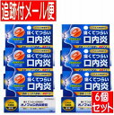 【6個セット】【第(2)類医薬品】オノフェ口内炎軟膏 5g 協和薬品工業【メール便送料無料/6個セット】