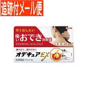 【第2類医薬品】オデキュアEX 12g【メール便送料無料】