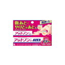 【メール便送料無料】【第2類医薬品】アットノンEX ジェル 15g 小林製薬