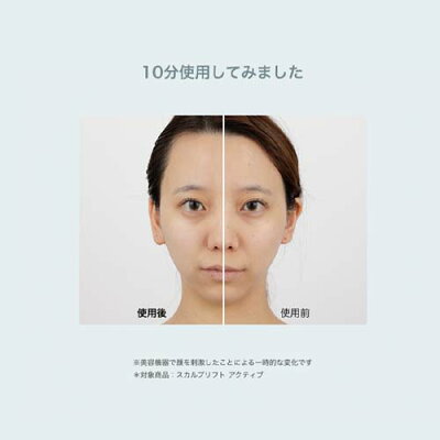 【ヤーマン公式】大人気スカルプリフトの最新モデル!(YA-MAN)ミーゼスカルプリフトアクティブ