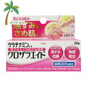 【第3類医薬品】ケラチナミンクロザラエイド 30g M:4987973113608