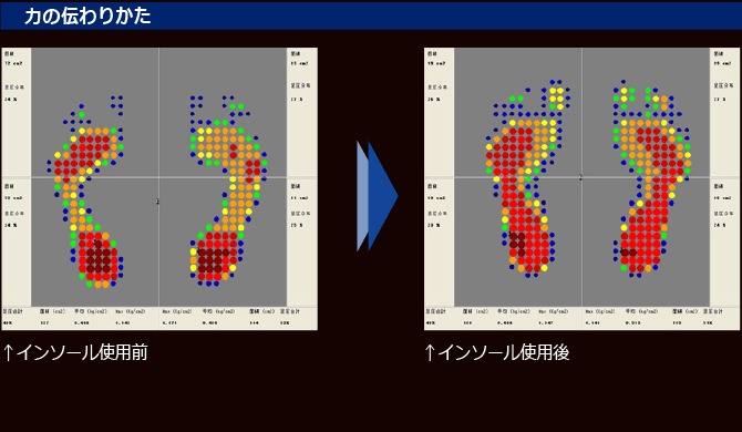 �ڥ��ݡ��Ĥ��饦�������󥰤ޤ��б���BMZ�ʥӡ����ॼ�åȡ�CCLP ����ѥ���ޡ��ȥե��å� ���󥽡�����õ��ʡۡ�NV�ͥ��ӡ������塼�ե��å��������ᾦ�ʡ���ȿ���桡Ω�������ݡ��ȡ����������ݡ��ȡ����ݡ��������б�