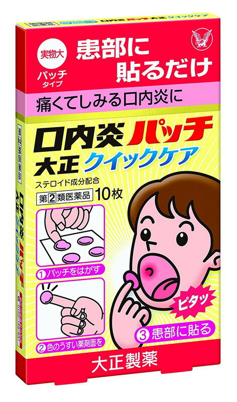 （指定第2類医薬品）大正製薬 口内炎パッチ大正クイックケア 10枚入