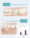携帯用 口腔洗浄機 超音波 口腔ケア マウスウォッシャー 歯磨き 矯正 歯間 歯垢洗浄 USB IPX7防水(2)