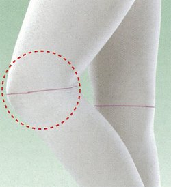 医療機器 弾性ストッキング アンシルク・プロJ ストッキング 片足 ホワイト M 足首周径19-23cm ふくらはぎ周径32-38cm 1枚 17583 アルケア
