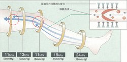 医療機器 弾性ストッキング アンシルク・プロJ ハイソックス 両足 ホワイト S 足首周径17-21cm ふくらはぎ周径28-34cm 1足 17424 アルケア